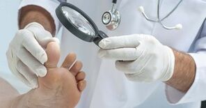 Doktor, mantardan etkilenen bacağını inceler